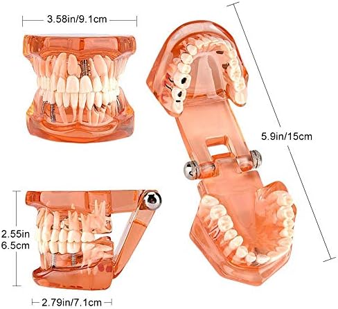 Модел на зъбите за Обучение Демонстрационному изследване на Стоматологично заболяване Оранжев цвят Свалящ се за Зъболекар и Училище